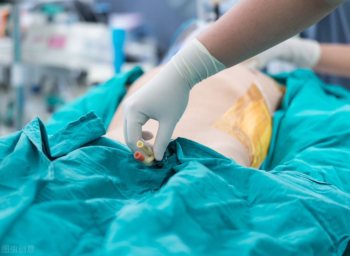 老年防漏尿护理裤头,老年漏尿锻炼方法