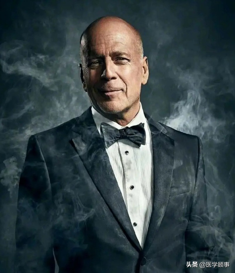 67岁的好莱坞影星因“失语症”退出娱乐圈,什么是失语症？