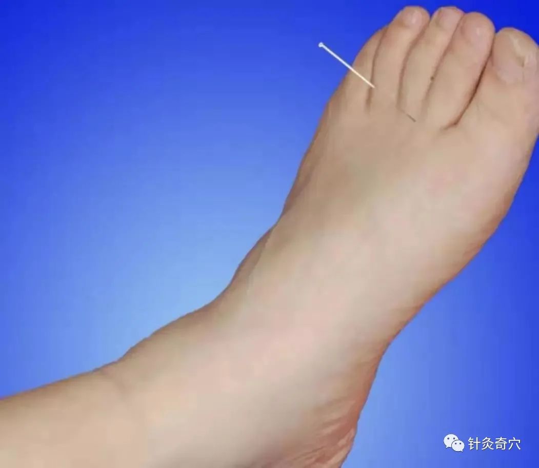 史上最全中医针灸视频教程全集,针灸治疗真实图片大全