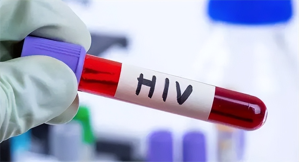 人感染艾滋存活时间,成年人艾滋病的潜伏期是多久