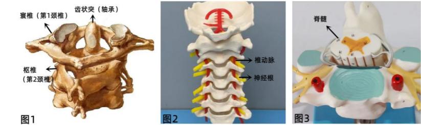脊髓型颈椎病手术费用一览表,椎动脉型颈椎病手术风险多大