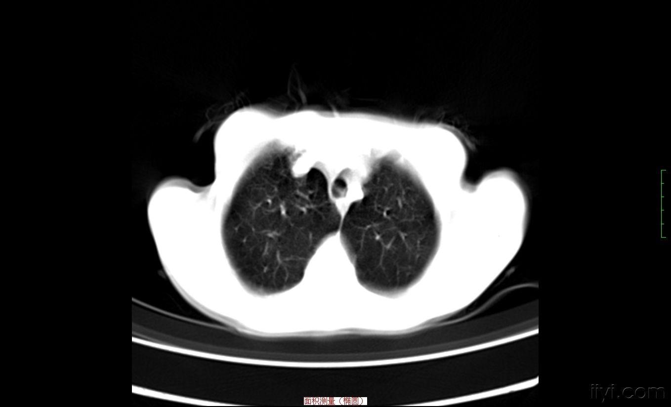 甲硝唑治牙痛多少钱,几块一瓶的甲硝唑能治4种病