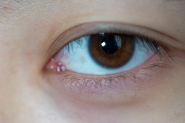 关于用眼健康知识,如何健康用眼小知识