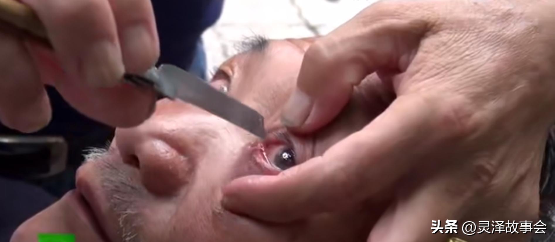 四川绝活刀锋洗眼有什么效果,正宗成都刀锋洗眼视频