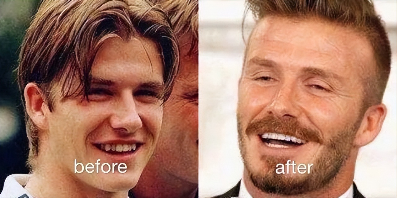 c罗内马尔厄齐尔,c罗内马尔贝尔照片