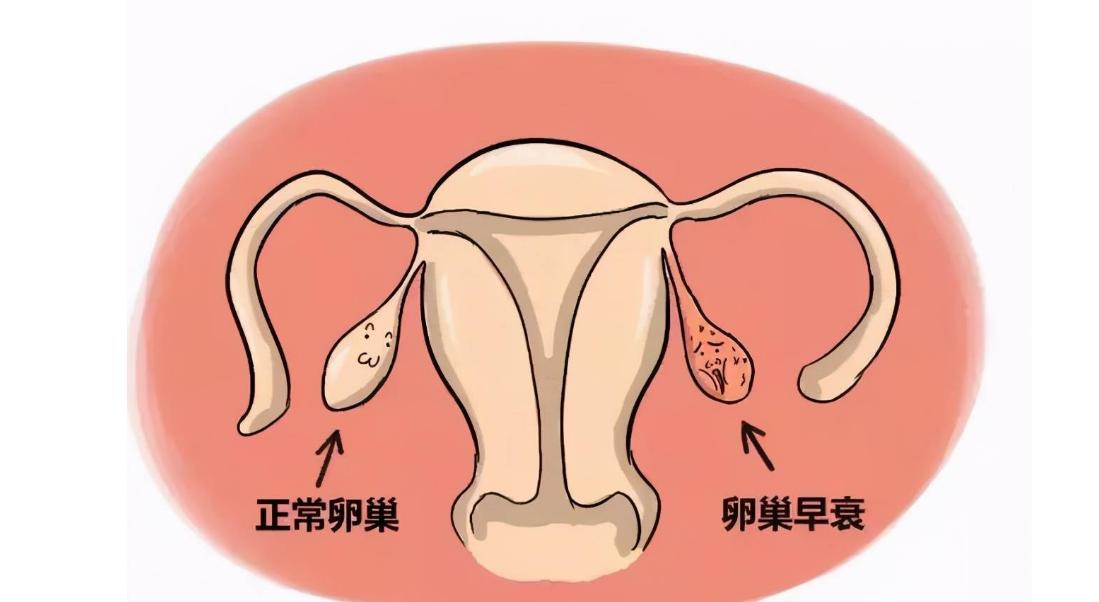 女性妇科疾病的10个征兆,妇科检查发现病变什么意思