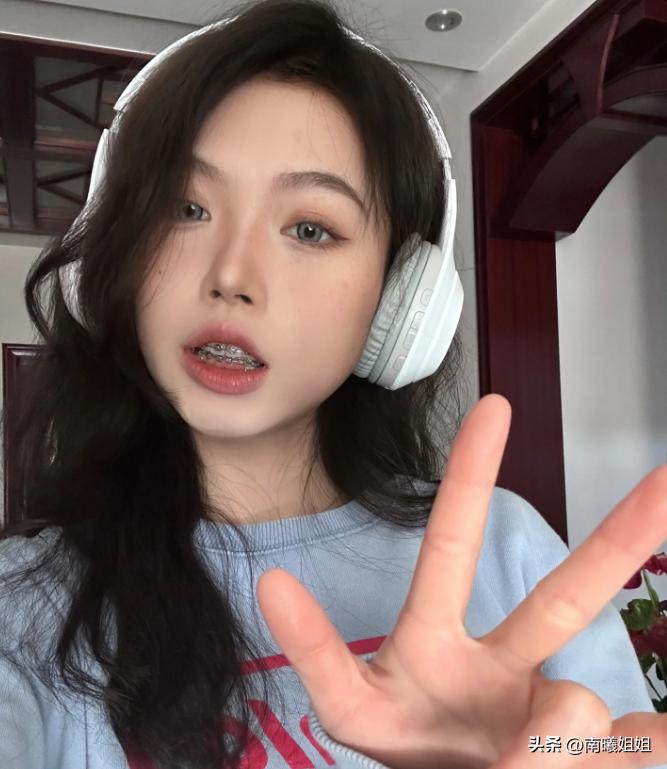 蒜头鼻却很漂亮的原因,蒜头鼻是真的影响颜值