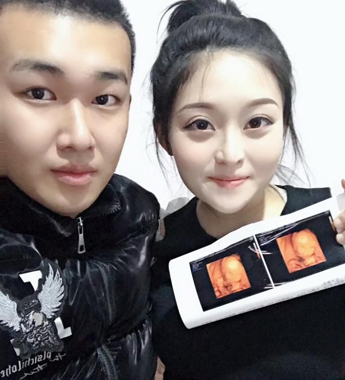 侏儒网红李会娟穿婚纱,侏儒症李会娟抖音