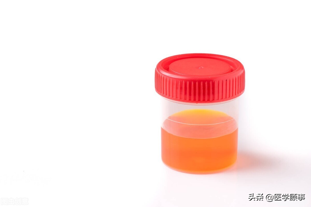 尿分叉尿流变细是怎么回事,尿分叉和尿次数多是什么原因