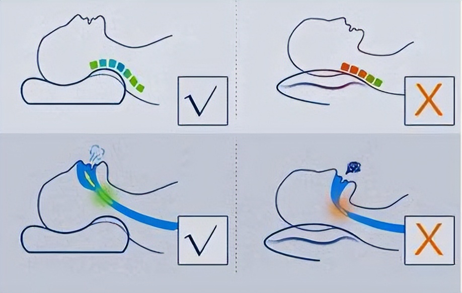 脖子一受凉就落枕这是怎么回事,脖子落枕怎样治才能好