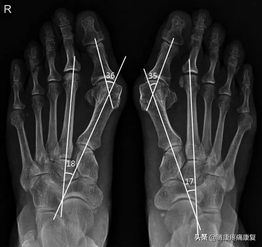 让脚变瘦的动作方法,有助于身体健康的动作