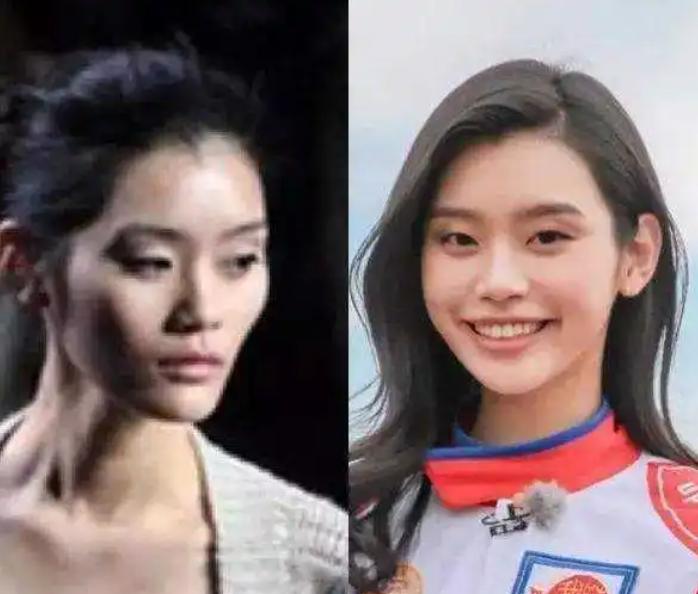 方脸和高颧骨怎么抗老,高颧骨好看还是低颧骨抗老