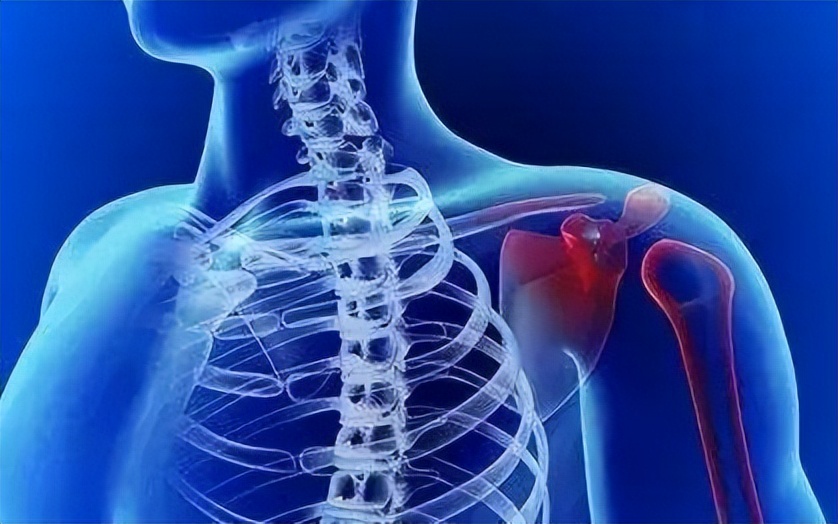 肩疼持续一年多了会不会是癌症,癌症引起的肩痛症状