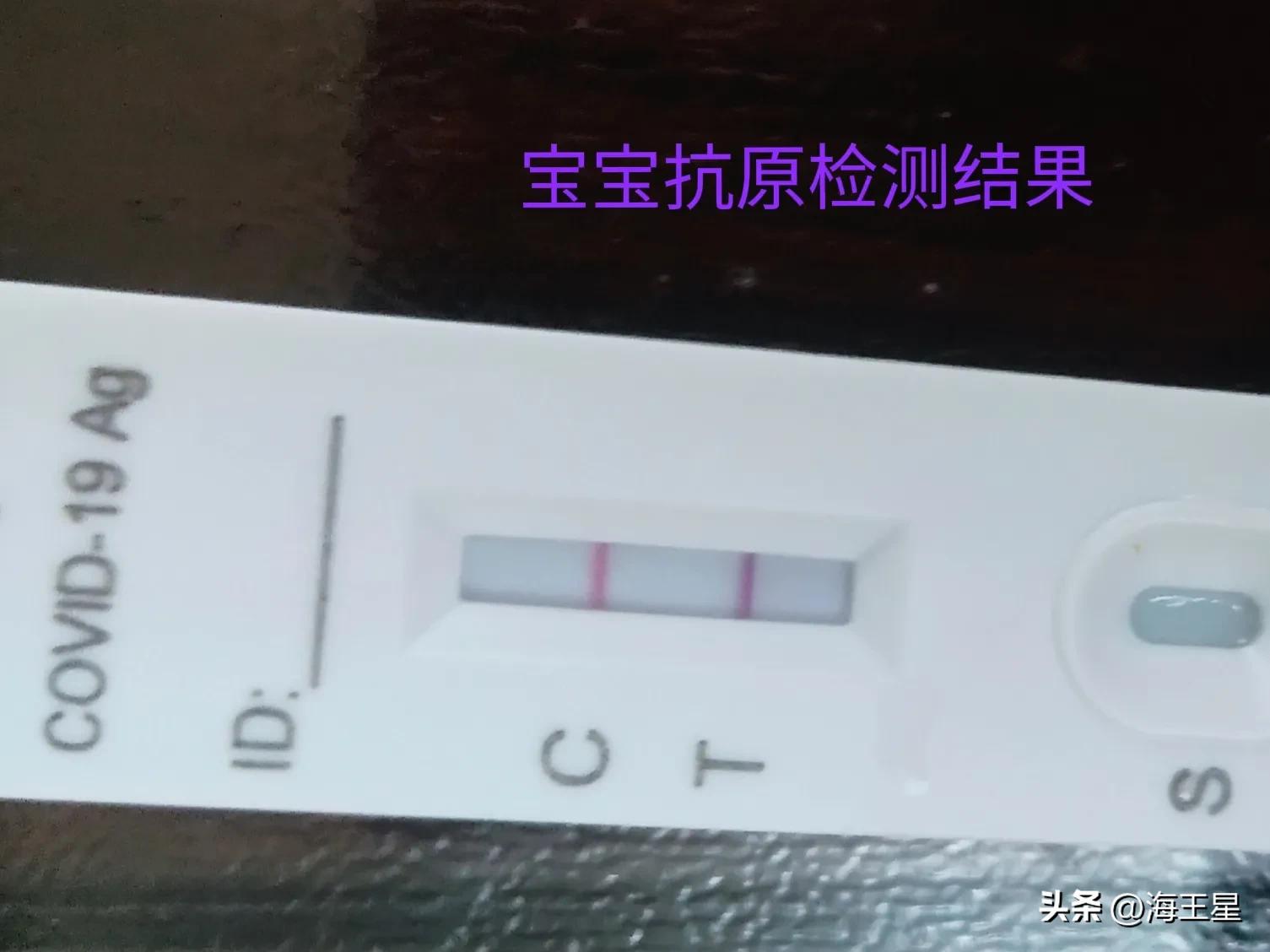 宝宝感染新冠热性惊厥表现,宝宝感染新冠高热惊厥怎么办