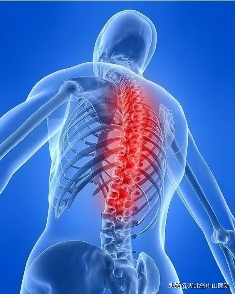 中山大学强直性脊柱炎,中山哪个医院治疗强直性脊柱炎