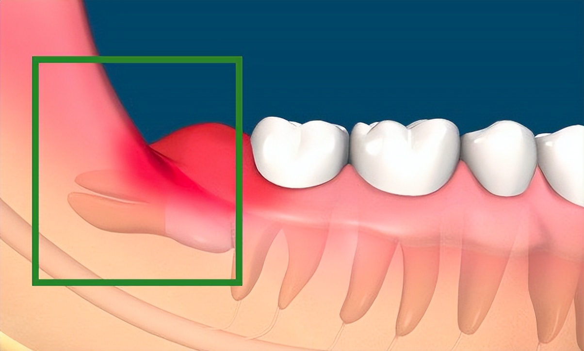 人体最鸡肋的器官,人体最不靠谱的器官