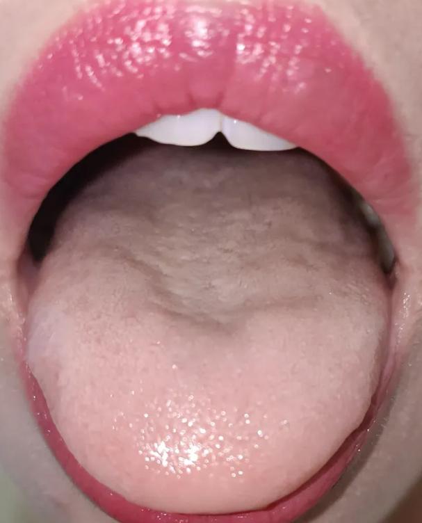 想不到，用这个方子不到一个月，气血两亏导致的月经不调竟然好了