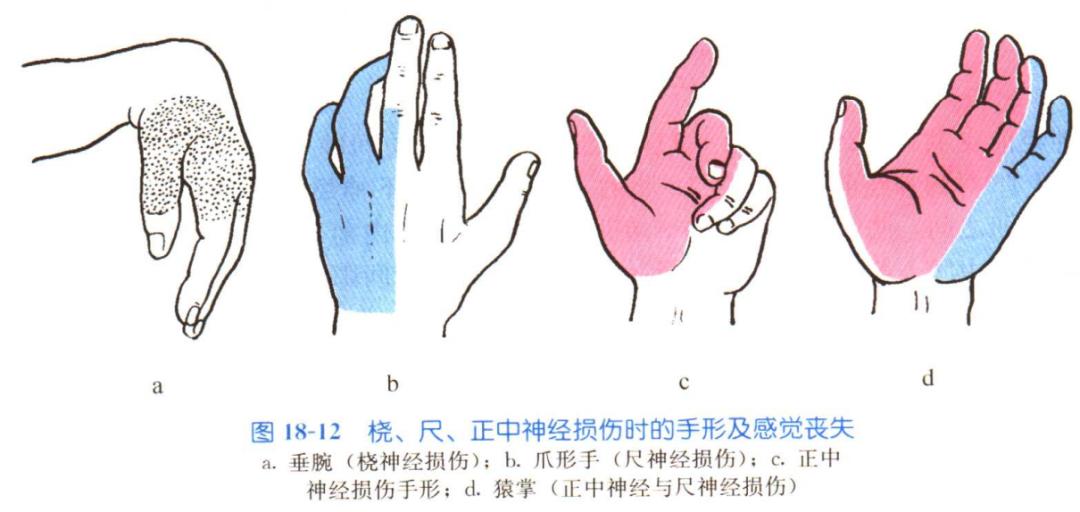 脊神经支配区域解剖图简图,脊神经及其分支的支配范围