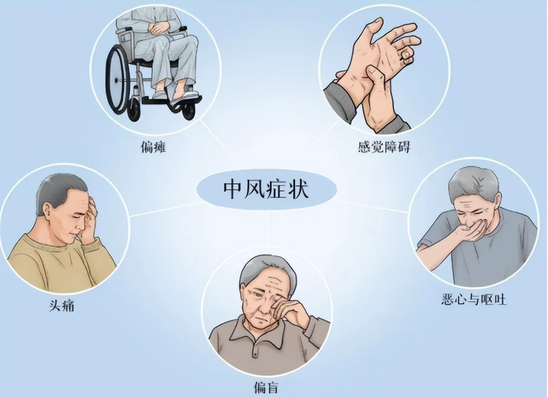 中风并发症会增加病死率，中医特色疗法针灸治疗效果如何？