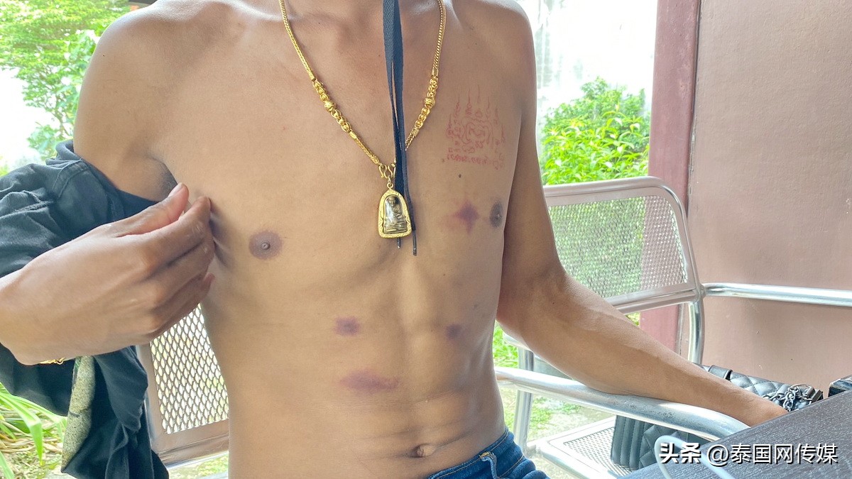 出轨还吸毒！泰国男同约炮士兵遭*虐性**致全身多处受伤