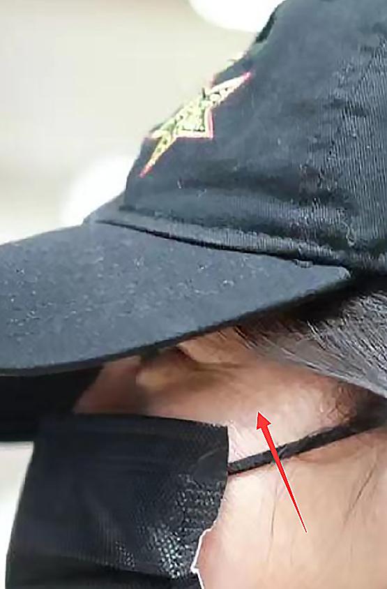 赵薇发福变胖后又满面油光出镜,赵薇近况发福图片