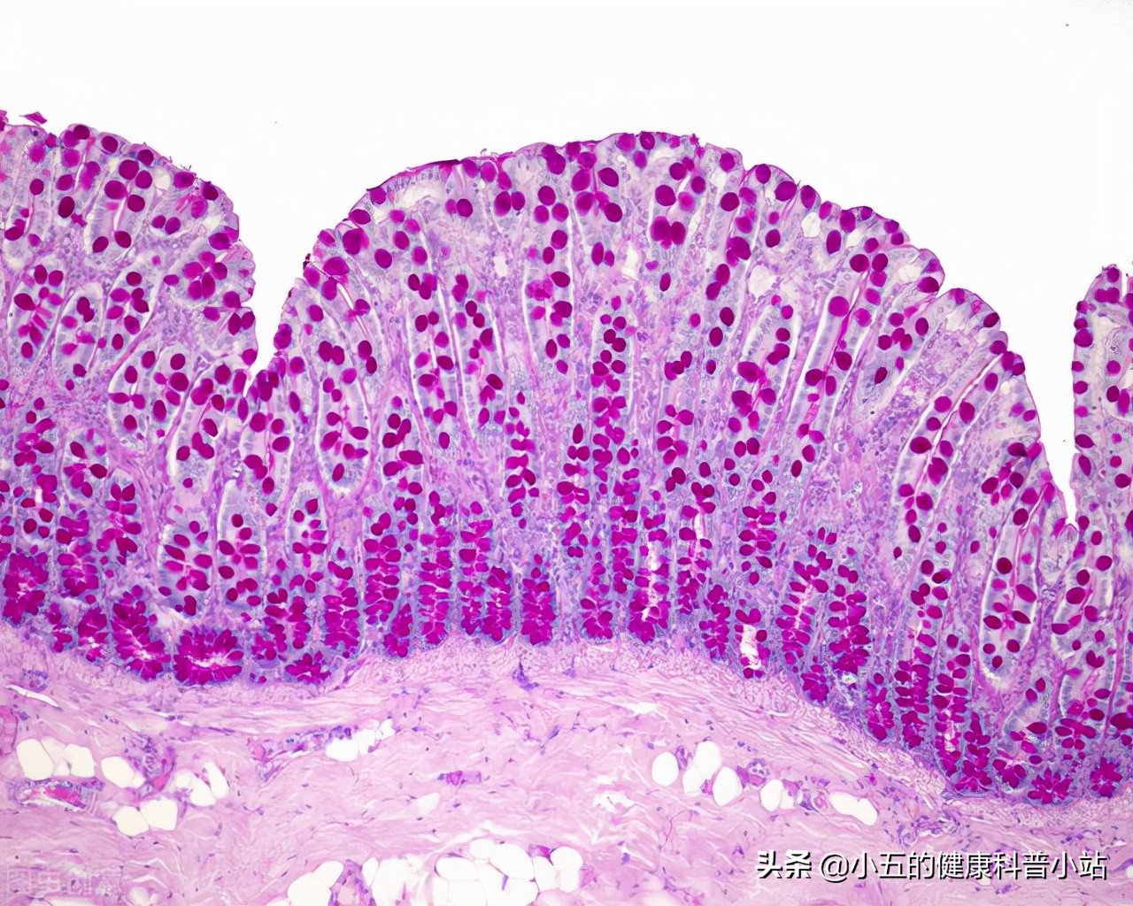 麻仁软胶囊是治疗老年便秘的常用药，能长期服用吗？一文说清