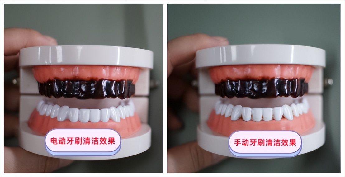 儿童用电动牙刷的好处与坏处：警告三*禁大**忌误区