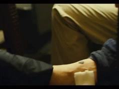 激光祛痣笔真的有用吗,冷冻祛痣好还是激光好