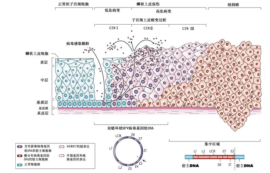 宫颈癌前病变抗病毒药物,宫颈癌的三大生物标志物