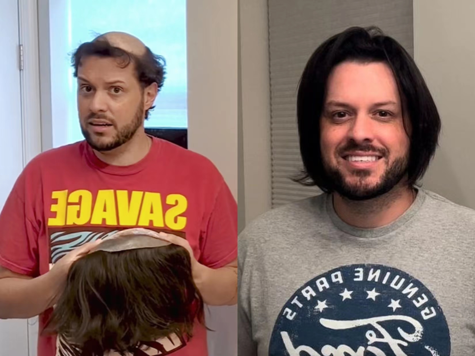 黄子韬真的把头发剃秃了吗,黄子韬变番薯头