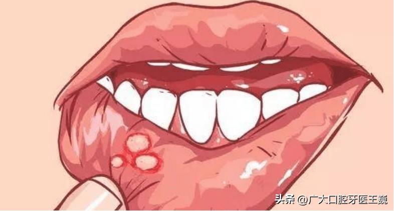 女博士洗牙感染梅毒假新闻,女博士小诊所洗牙被感染梅毒