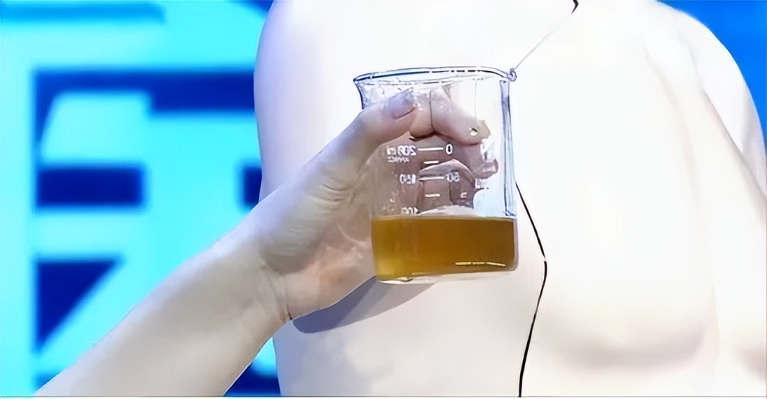 起夜频繁是得了夜尿症吗,经常起夜夜尿多是什么原因