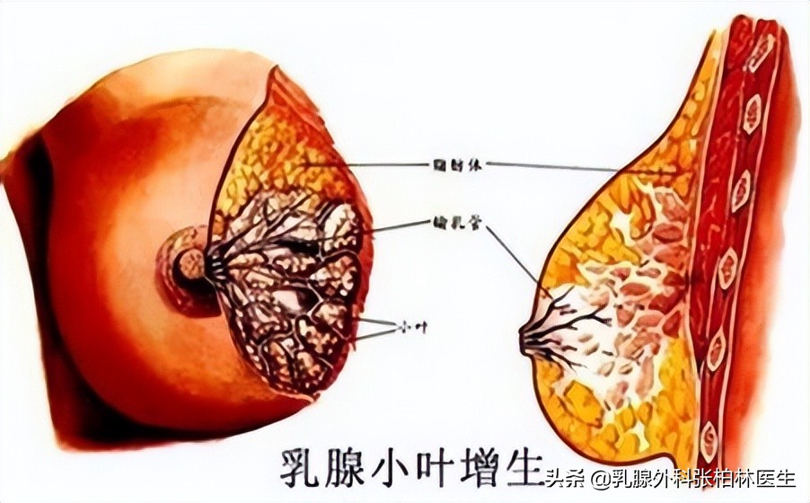 乳房出现这几种胀痛要警惕,乳房胀痛然后有肿块会自愈吗
