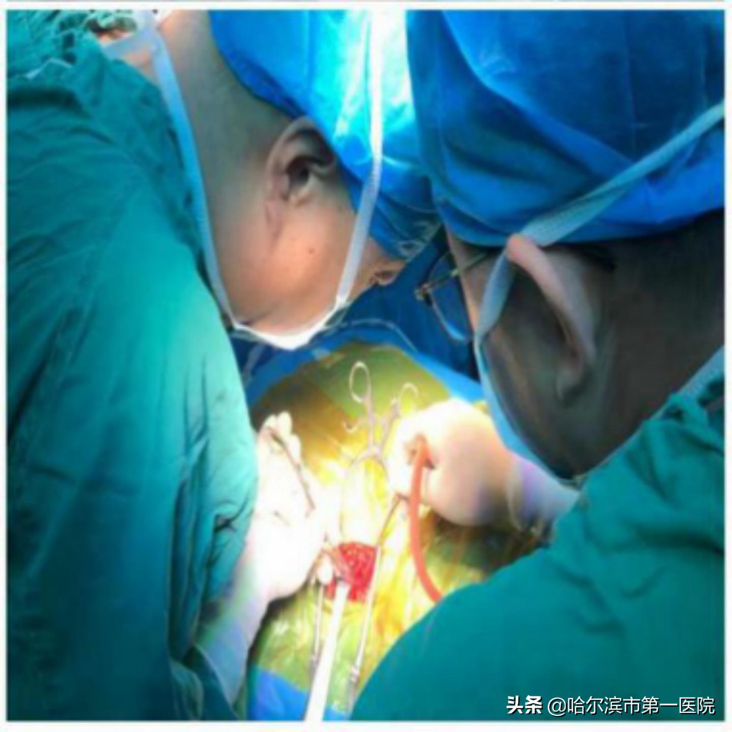 反复腰腿痛，去神经外科查查——哈市第一院神经外科成功完成首例腰椎峡部裂伴腰骶椎不稳术