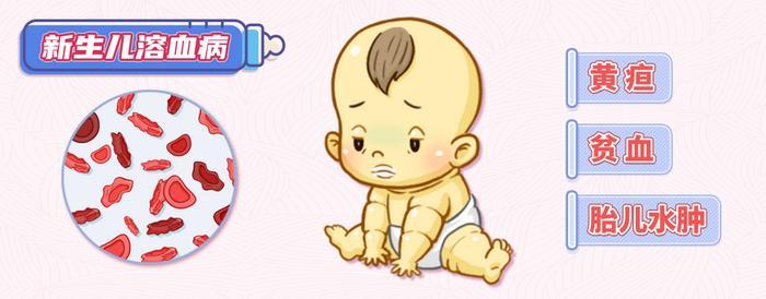 孕妈是o型血一定要做溶血检查吗,o型血孕妈喂母乳孩子体质更好吗