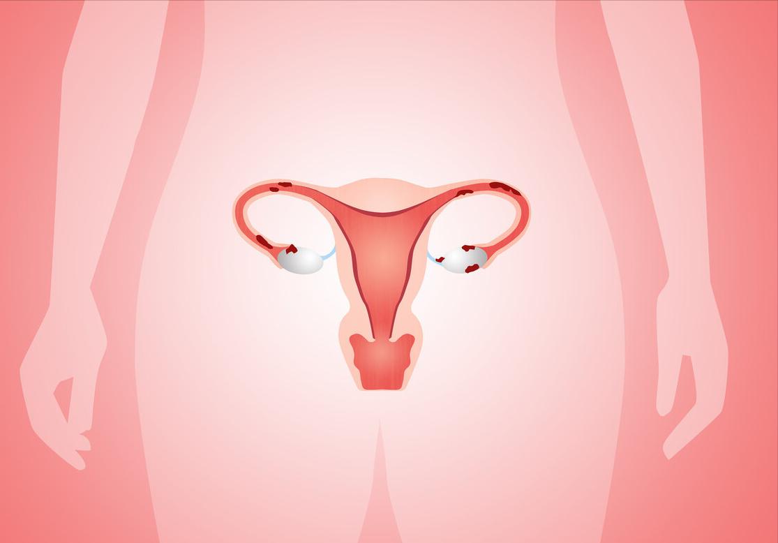 女人打什么针预防妇科疾病,妇科常见病的预防与治疗