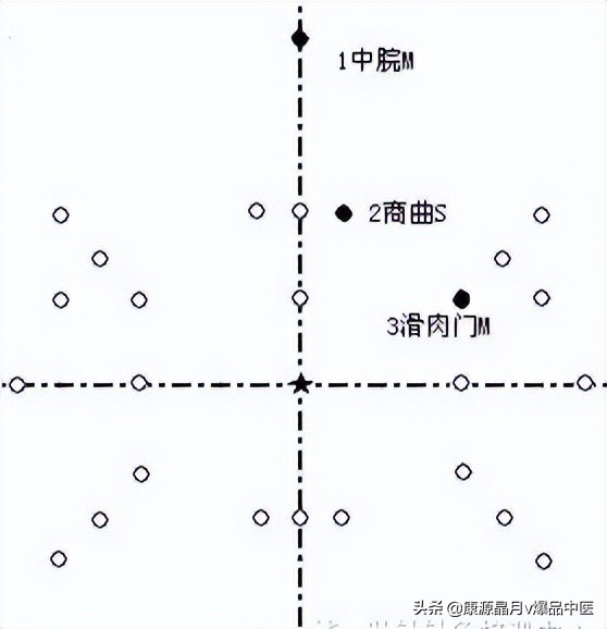 腹针疗法及16例常用处方