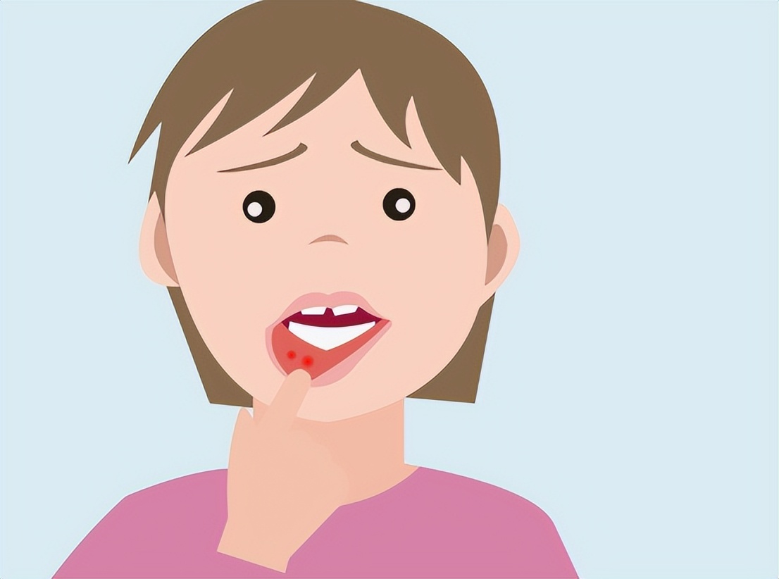 小儿口疮怎么治好得快,舌头上频繁长口疮是怎么回事