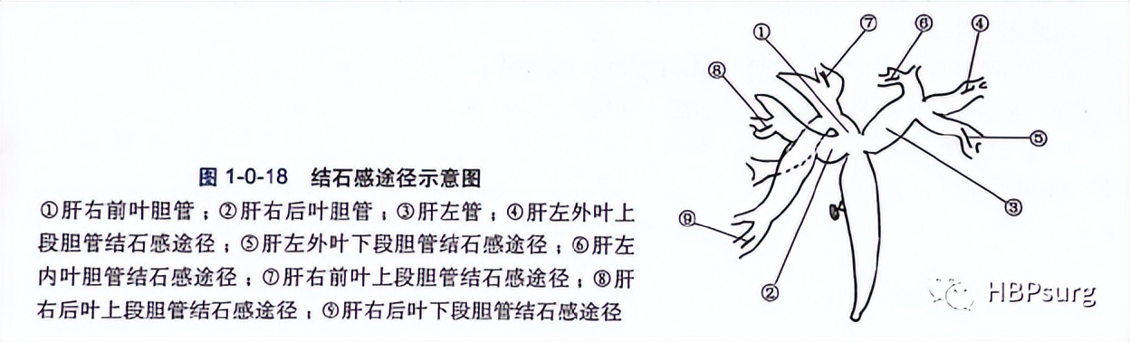 关于肝胆管结石治疗的入肝途径的总结