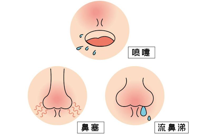 鼻咽炎三伏贴贴哪些穴位,三伏贴耳鼻喉疾病该贴哪
