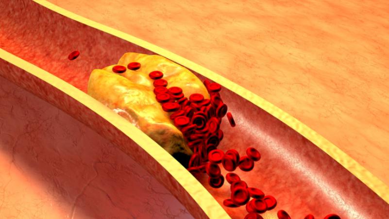 花生是心血管病的克星还是营养品,花生是心血管的祸根还是福音