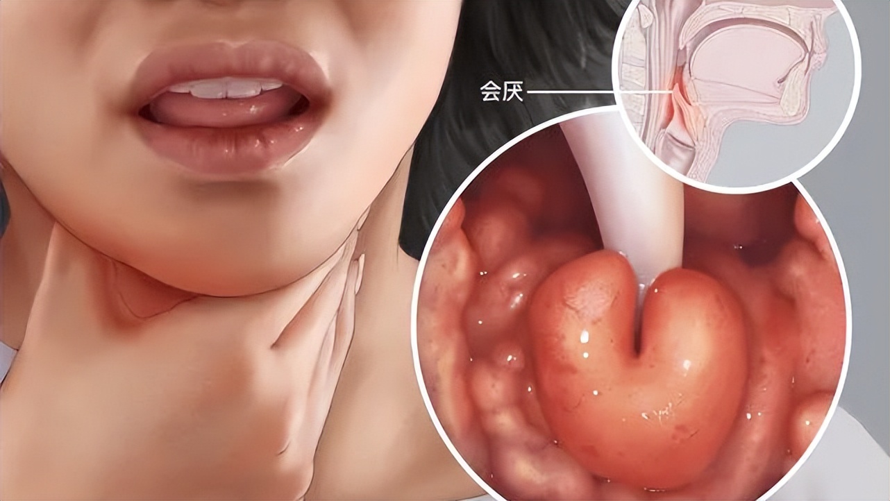 吃饭经常噎着是癌症吗,吃饭吃得很快会得什么疾病