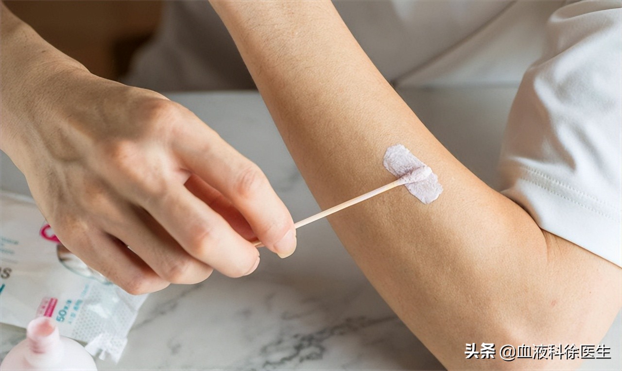 有种剧痛叫带状疱疹,有一种痛叫带状疱疹七类人要小心