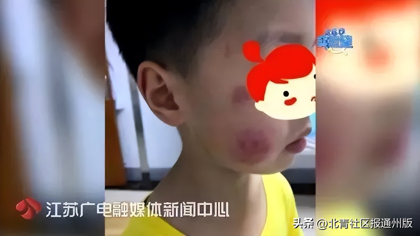 一小孩误食磁力球,幼童误食28颗磁力珠被救