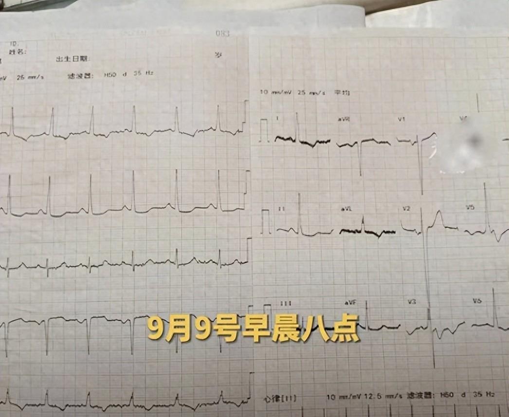 青岛医院火化尸体后续,山东青岛死亡事件