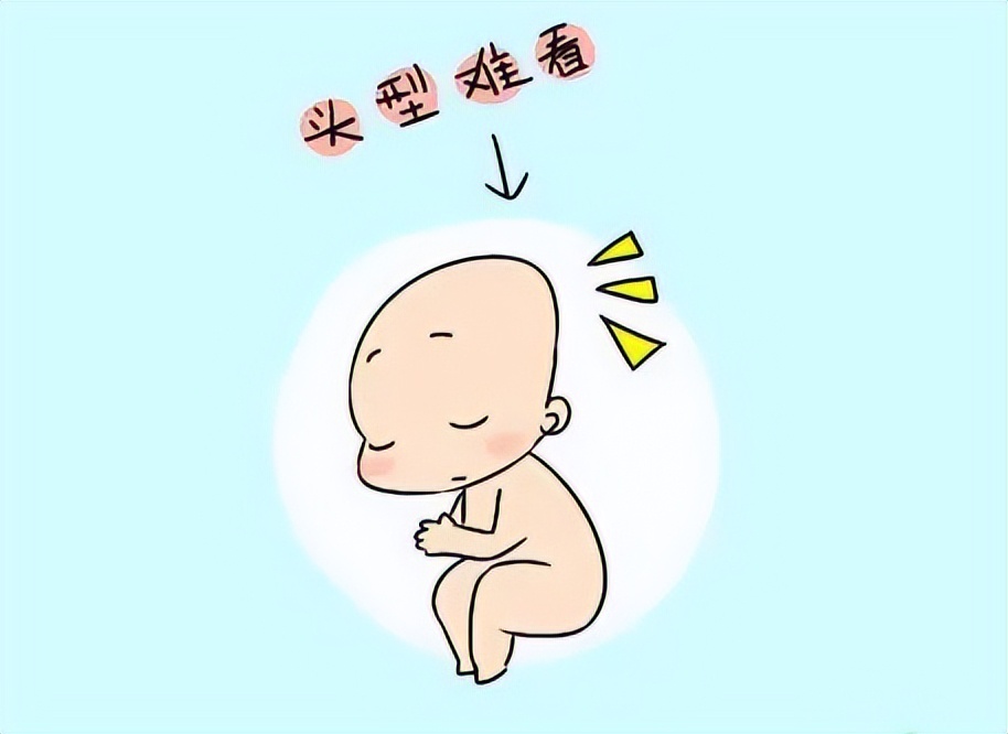 顺产导致婴儿头部挤压变形,月嫂带婴儿都扁脑袋