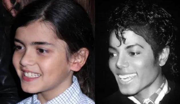 迈克尔杰克逊去世得了什么疾病,迈克杰克逊儿子遗传白化病