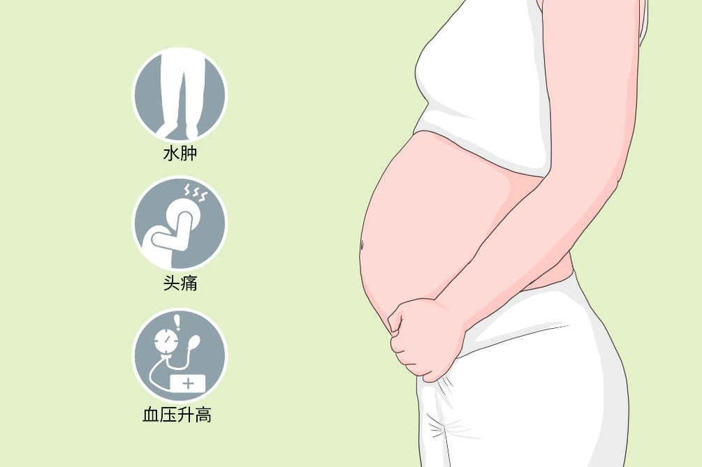 重度子痫前期母亲,重度子痫前期会引发心衰吗