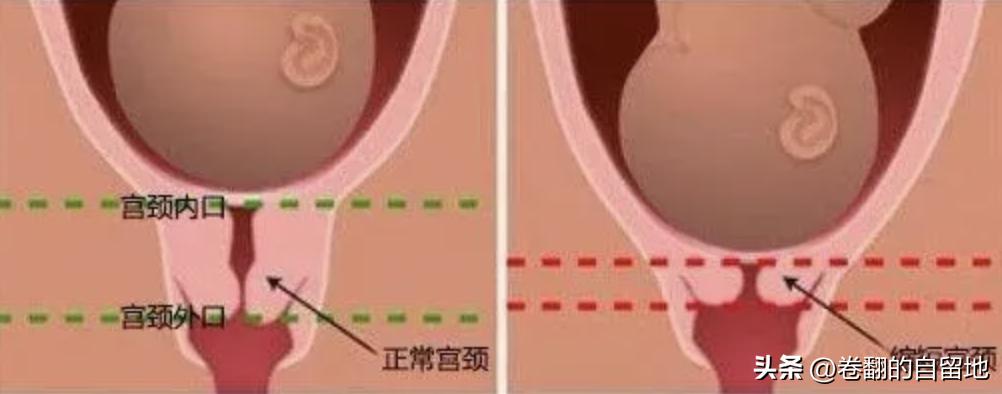 孕晚期宝宝突然不动也没有宫缩,孕晚期宝宝突然不怎么动怎么回事