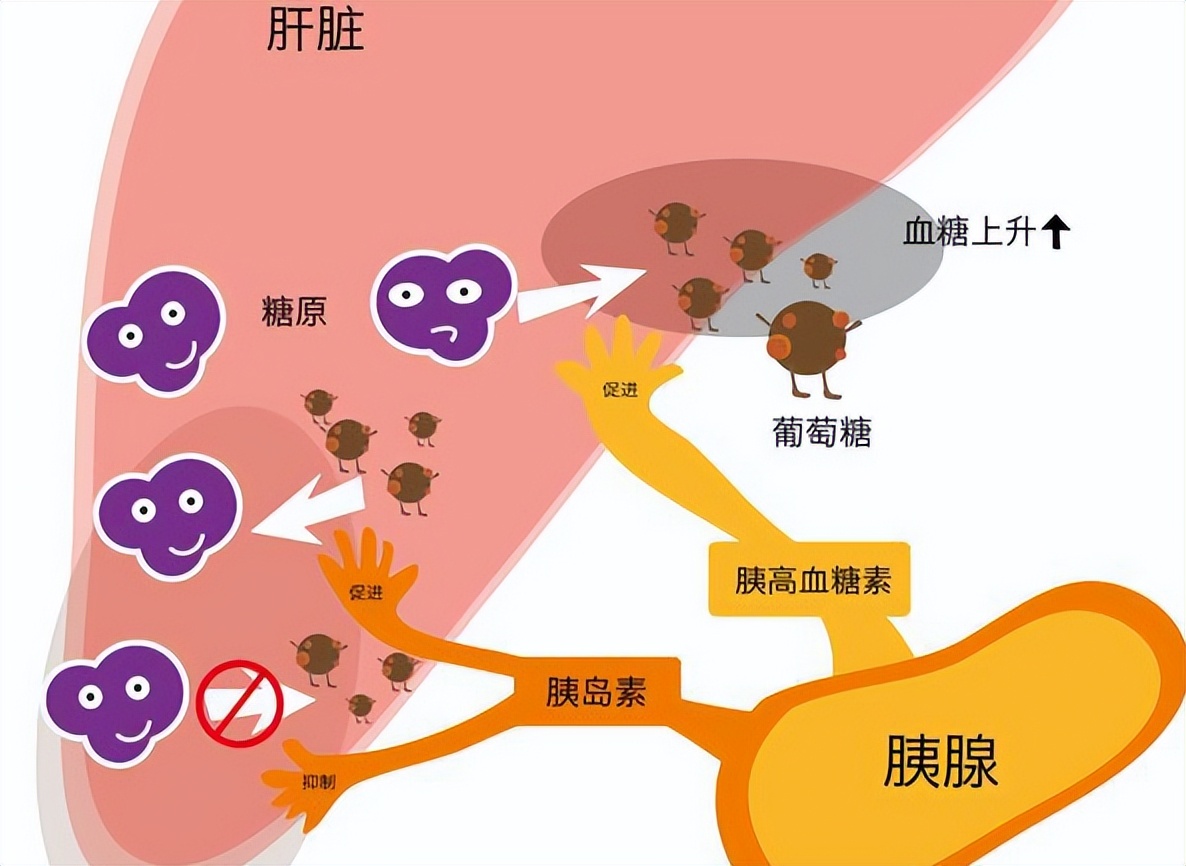 糖尿病罪魁祸首是什么,糖尿病罪魁祸首完整视频